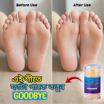 Ultimate Moisturizing Protective Foot Cream – 7-Day Powerful Heel Repair Solution